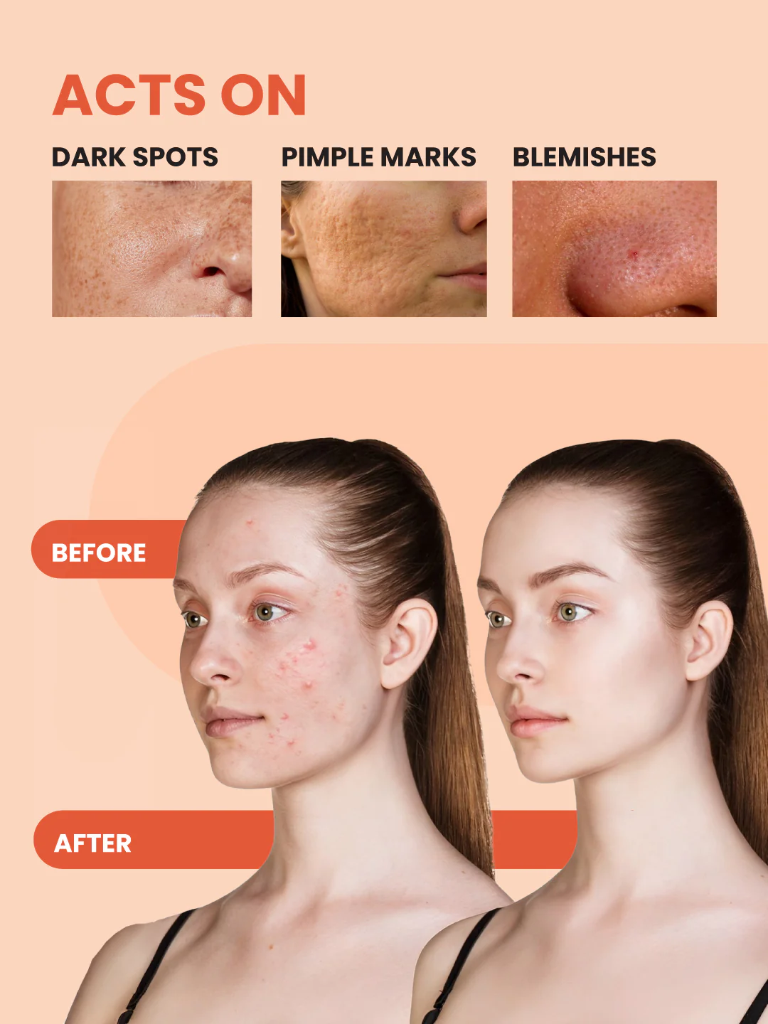 Urban Yog Anti-Pigmentation Serum - Image 3