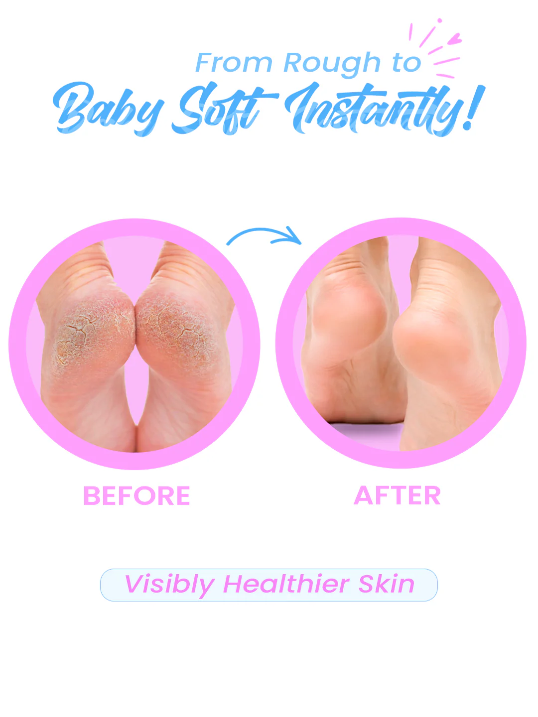 Urban Yog Callus Remover - Image 4