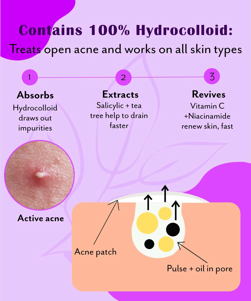 Urban Yog Curvy Pimple Patch - Image 3