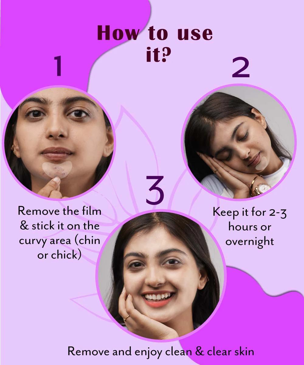 Urban Yog Curvy Pimple Patch - Image 5