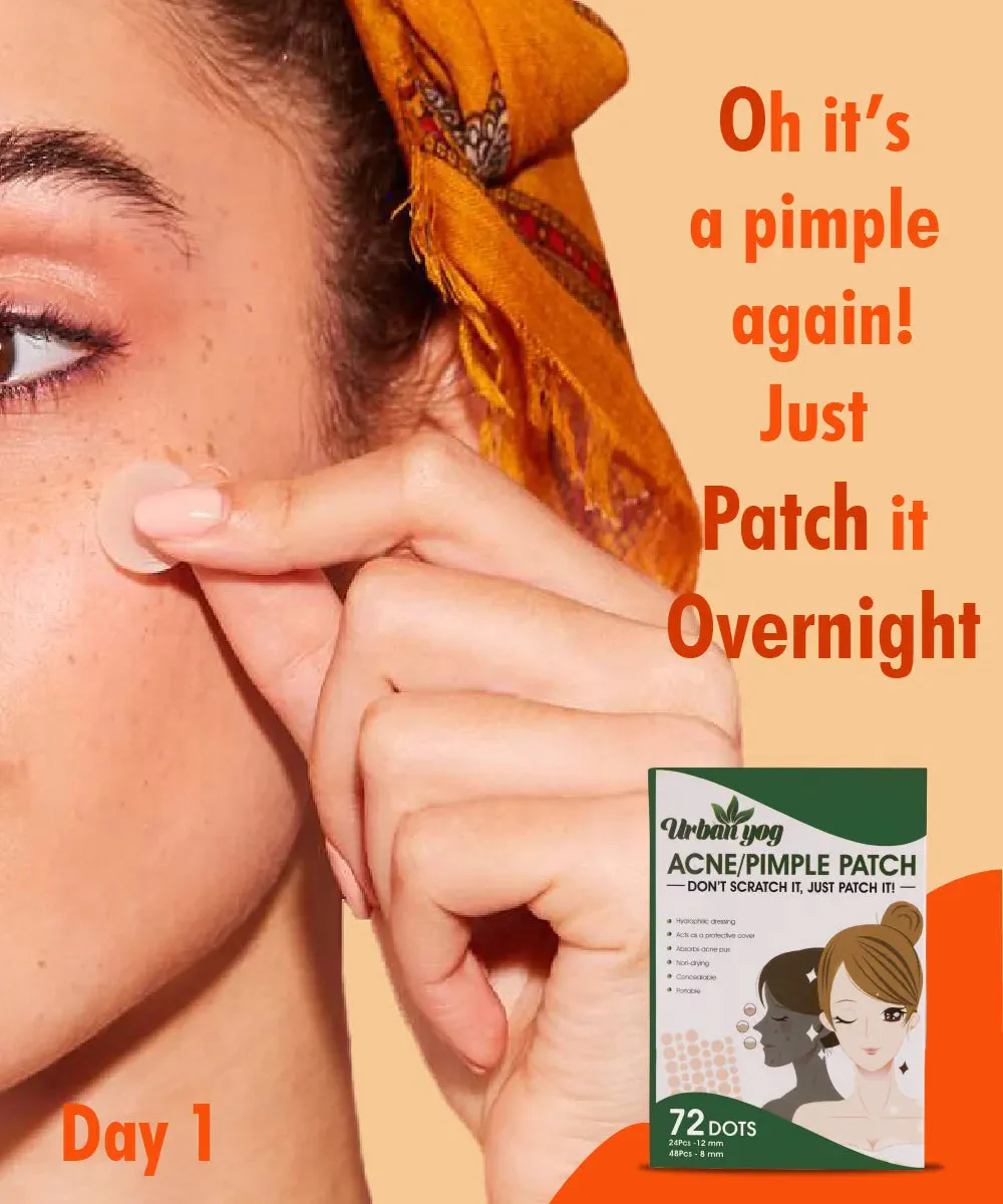 Urban Yog Face Care Combo Kit - Anti-Pigmentation Serum (30 ml) and Acne Pimple Patch (72 Dots) - Image 3